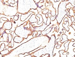 Alkaline Phosphatase/ALPP Antibody (PL8-F6), Novus Biologicals 0.2mg; Unlabeled:Antibodies,